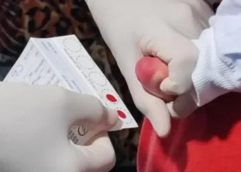 Sespa ressalta importância do pré-natal para prevenir a toxoplasmose congênita